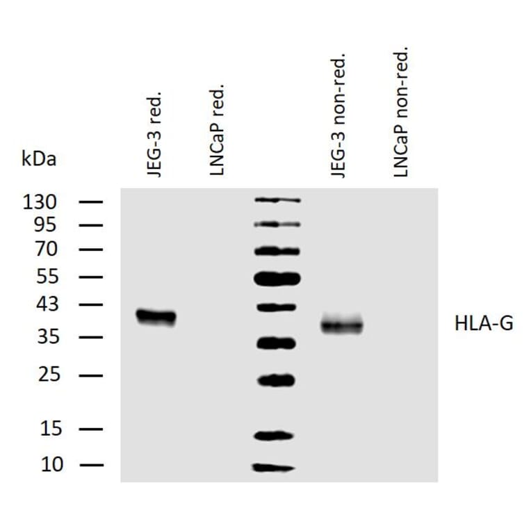 WB - Anti-HLA G Antibody [MEM-G/1] (A86276)