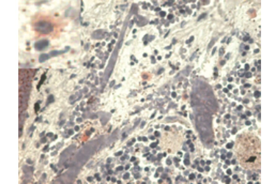 Immunohistochemistry - Anti-HLA G Antibody [MEM-G/1] (A86275) - Antibodies.com