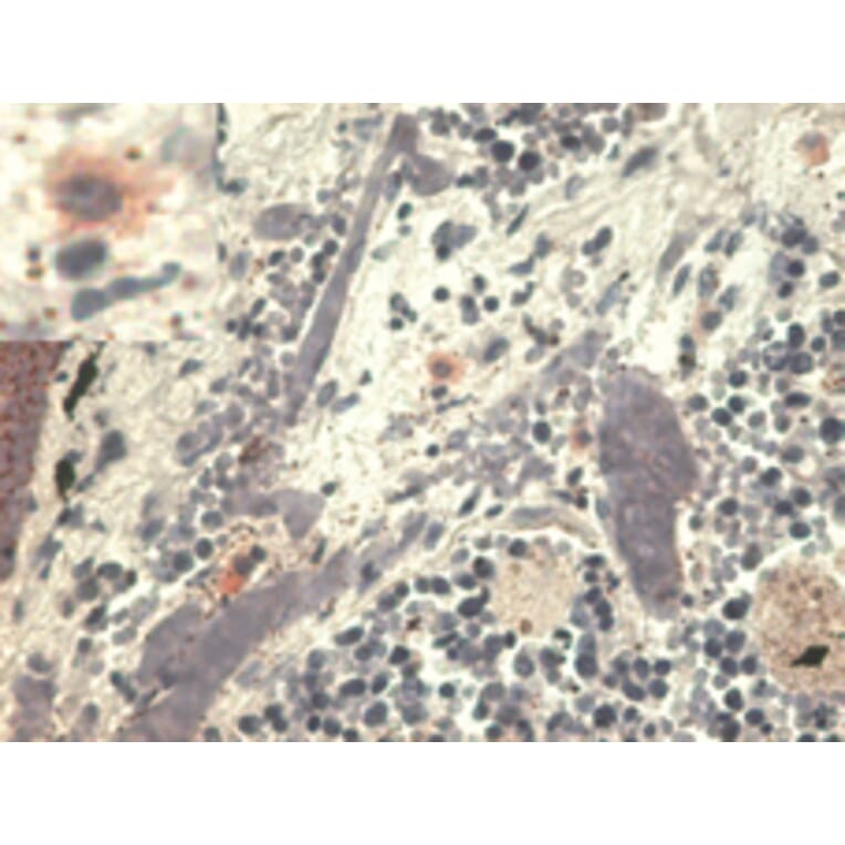 Immunohistochemistry - Anti-HLA G Antibody [MEM-G/1] (A86275) - Antibodies.com