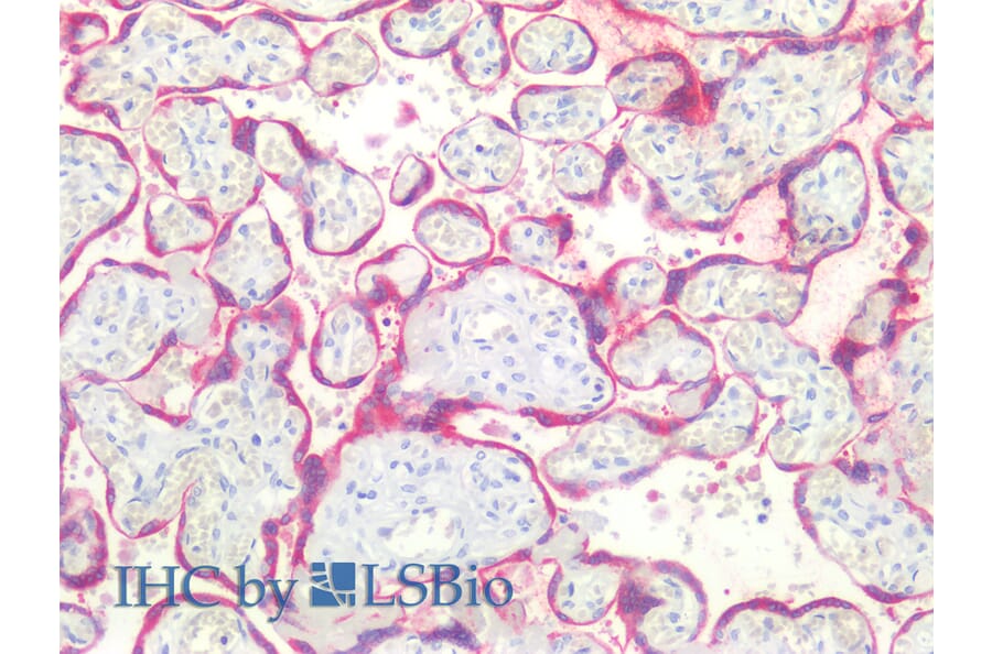 IHC - Anti-Bcl-2 Antibody [Bcl-2/100] (A86278)