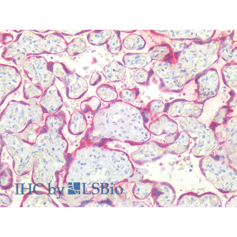 IHC - Anti-Bcl-2 Antibody [Bcl-2/100] (A86278)