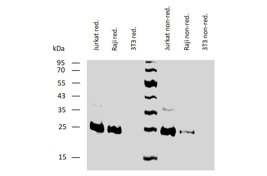 WB - Anti-Bcl-2 Antibody [Bcl-2/100] (A86278)