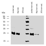 WB - Anti-Bcl-2 Antibody [Bcl-2/100] (A86278)