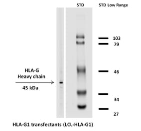 Western Blot - Anti-HLA G Antibody [MEM-G/1] (Biotin) (A86276) - Antibodies.com
