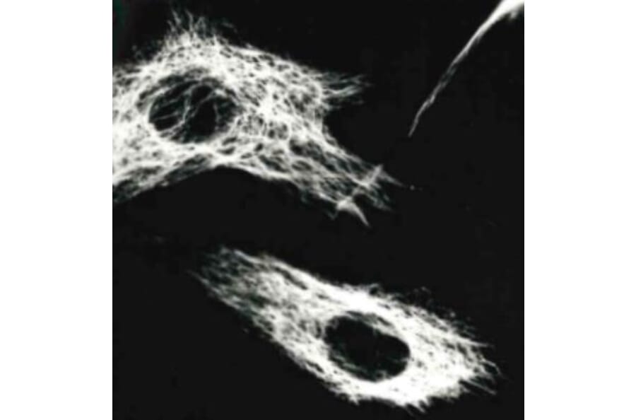 ICC - Anti-Vimentin Antibody [VI-01] (A86296)