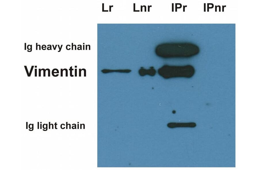 IP - Anti-Vimentin Antibody [VI-01] (A86296)