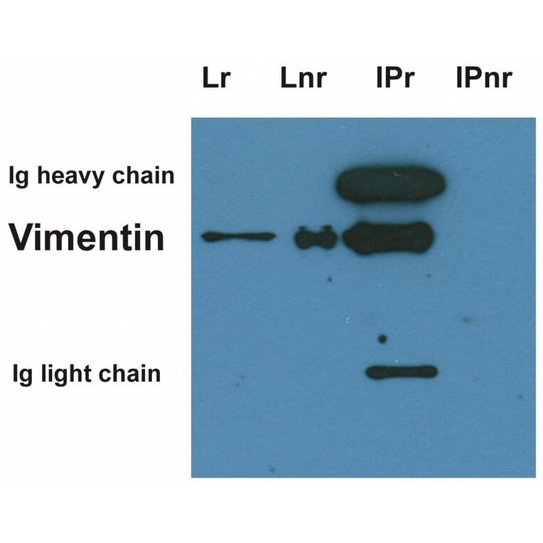 IP - Anti-Vimentin Antibody [VI-01] (A86296)