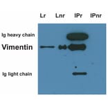 IP - Anti-Vimentin Antibody [VI-01] (A86296)