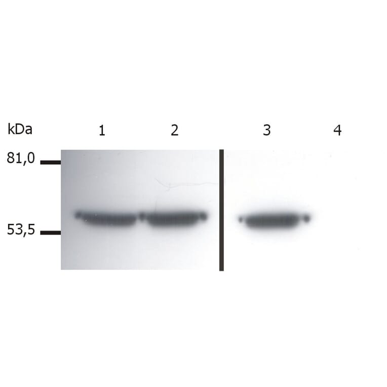 Western Blot - Anti-Vimentin Antibody [VI-01] (A86296) - Antibodies.com