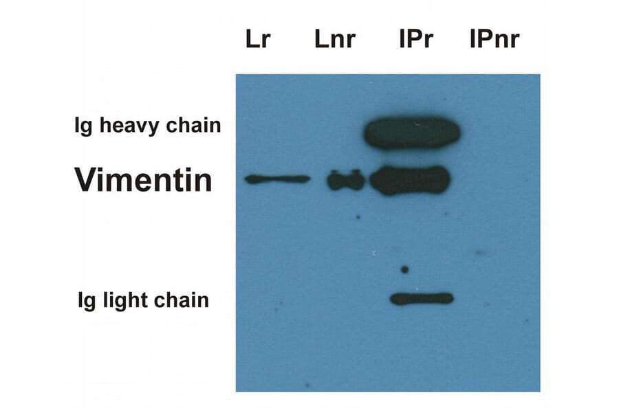 Western Blot - Anti-Vimentin Antibody [VI-01] (A86284) - Antibodies.com