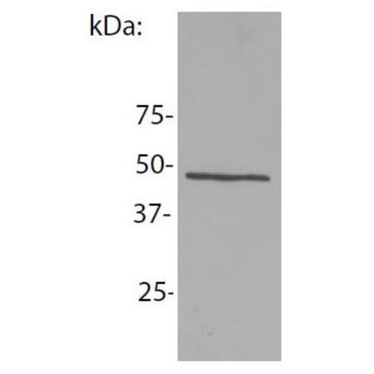 WB - Anti-NCK1 Antibody [EM-06] (A86308)