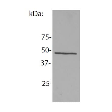 Western Blot - Anti-NCK1 Antibody [EM-06] (A86307) - Antibodies.com