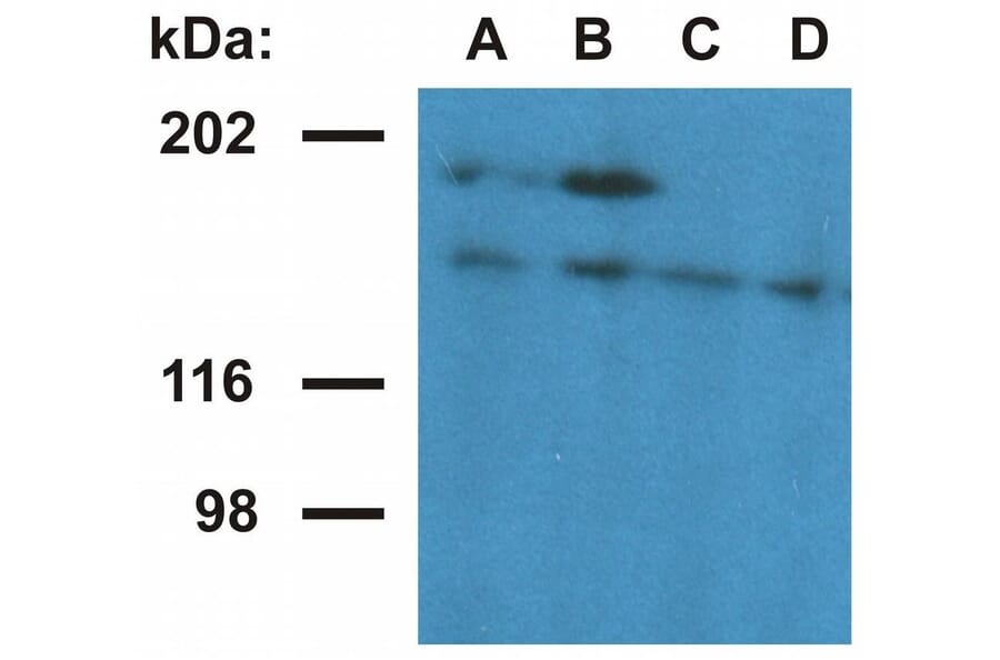 WB - Anti-Ubinuclein 1 Antibody [UBN1-02] (A86314)