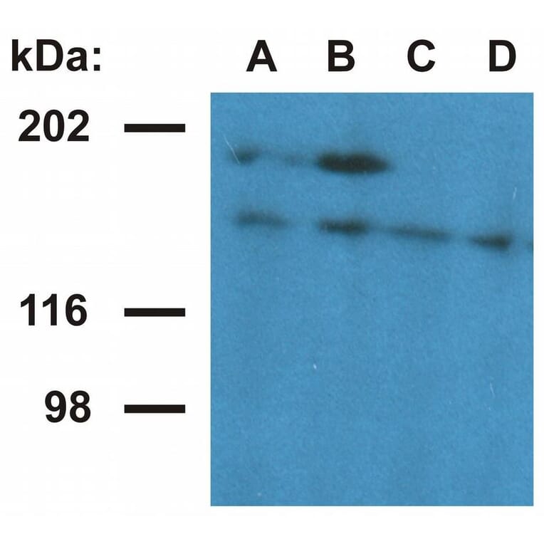 WB - Anti-Ubinuclein 1 Antibody [UBN1-02] (A86314)