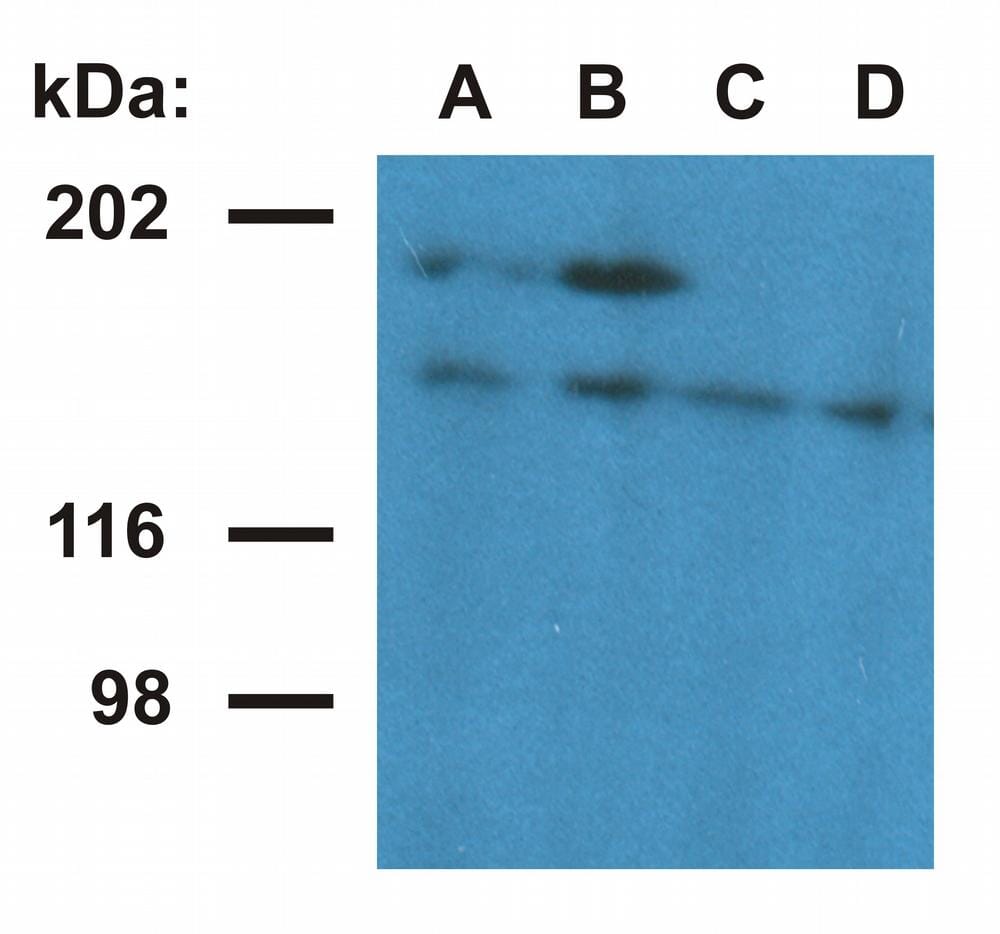 Western blotting analysis of ubinuclein in nuclear fraction of HeLa cells. Anti-Ubinuclein 1 Antibody [UBN1-01] (Lane A, B) detects ubinuclein 1 (165 kDa) and an 180 kDa protein - presumable ubinuclein 2. Anti-Ubinuclein 1 Antibody [UBN1-02] (Lane C, D) detects ubinuclein 1. Antibody dilution: A, C: 1 µg/ml; B, D: 5 µg/ml.