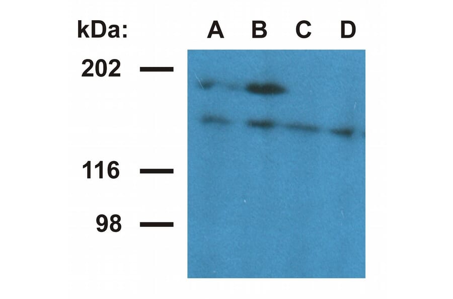 Western Blot - Anti-Ubinuclein 1 Antibody [UBN1-02] (A86313) - Antibodies.com