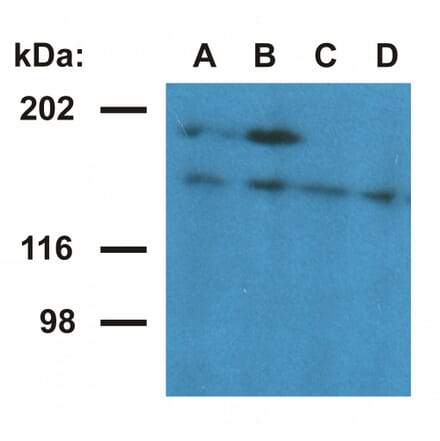 Western Blot - Anti-Ubinuclein 1 Antibody [UBN1-02] (A86313) - Antibodies.com