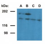 Western Blot - Anti-Ubinuclein 1 Antibody [UBN1-02] (A86313) - Antibodies.com