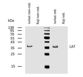 WB - Anti-LAT Antibody [LAT-01] (A86328)