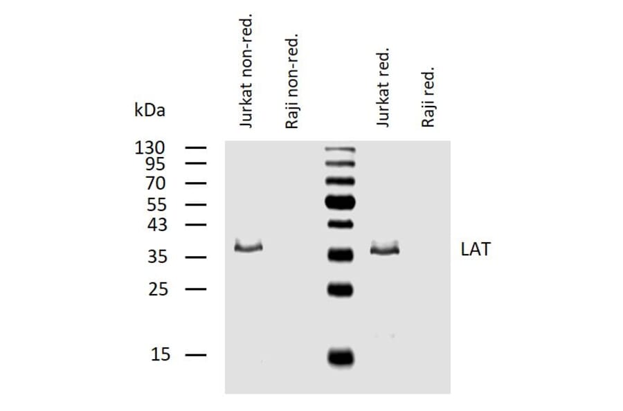 WB - Anti-LAT Antibody [LAT-01] (A86328)