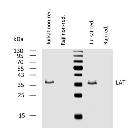 WB - Anti-LAT Antibody [LAT-01] (A86328)