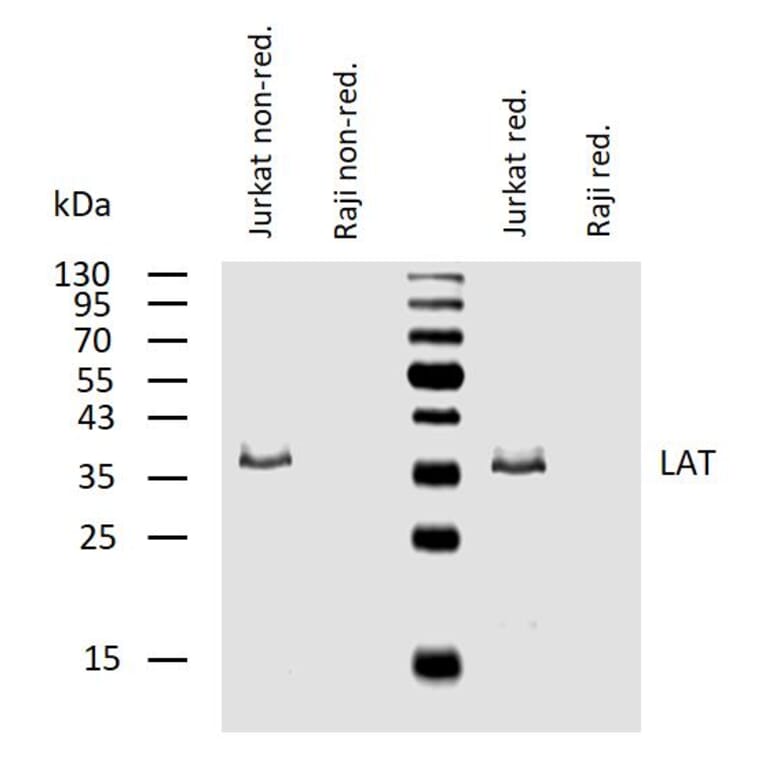 WB - Anti-LAT Antibody [LAT-01] (A86328)