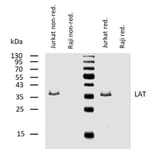 WB - Anti-LAT Antibody [LAT-01] (A86328)