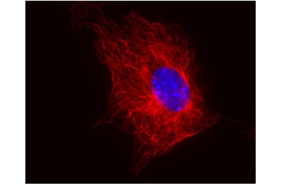 ICC - Anti-beta Tubulin Antibody [TU-06] (A86335)