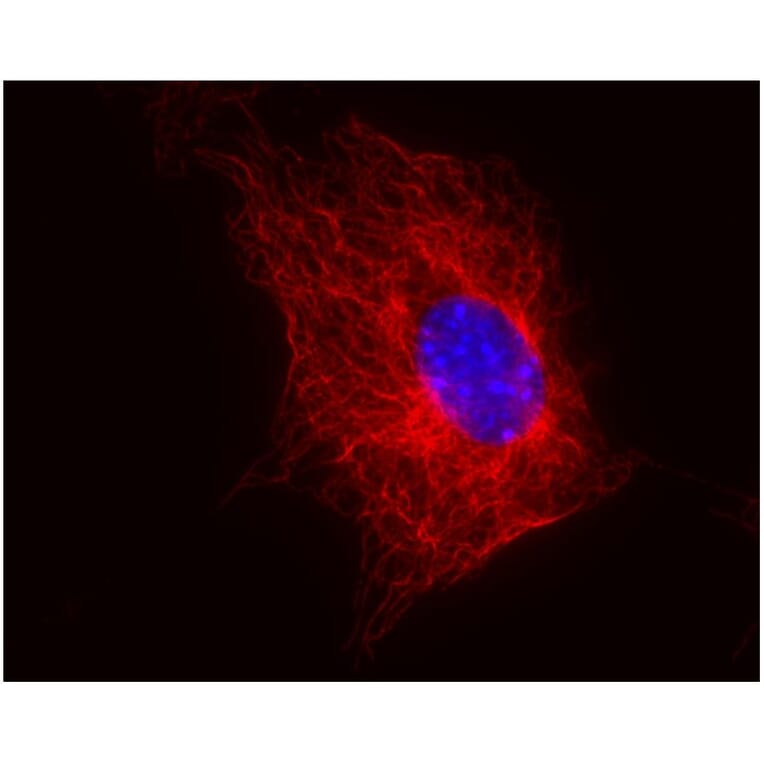 ICC - Anti-beta Tubulin Antibody [TU-06] (A86335)