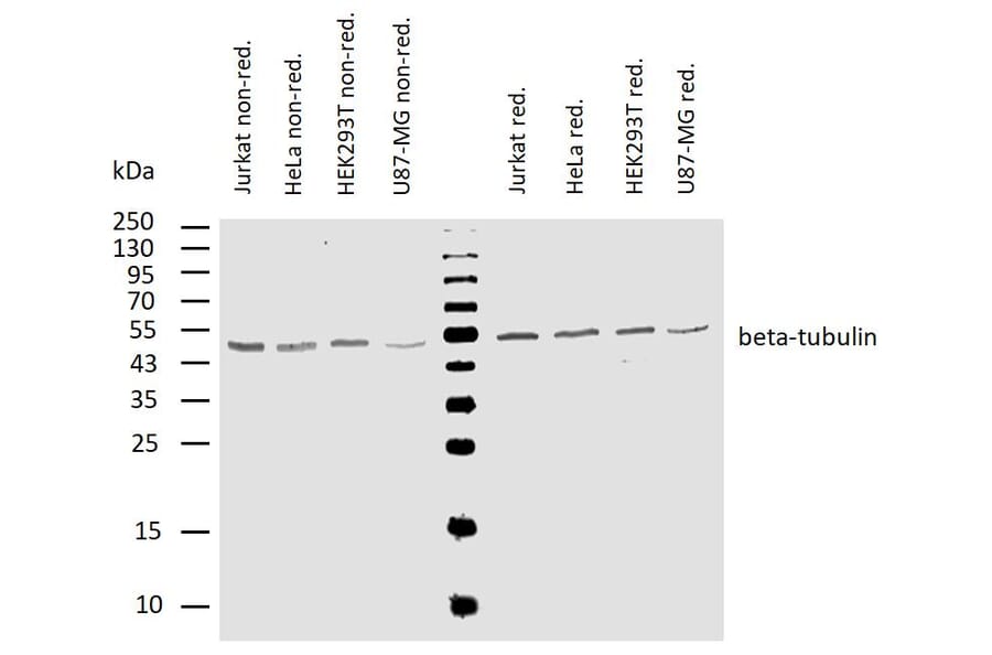 WB - Anti-beta Tubulin Antibody [TU-06] (A86335)