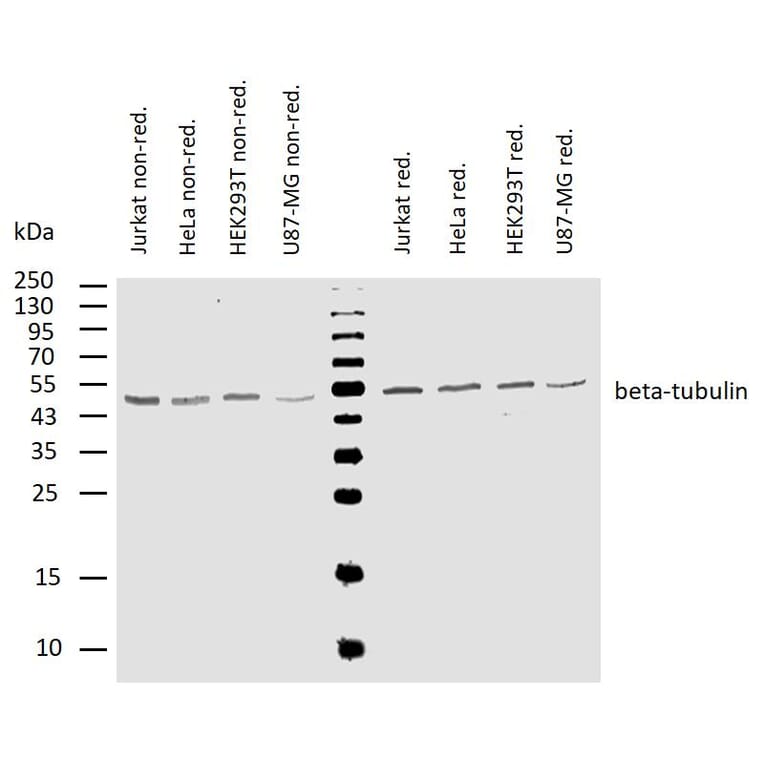 WB - Anti-beta Tubulin Antibody [TU-06] (A86335)
