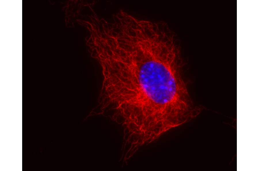 Immunocytochemistry - Anti-beta Tubulin Antibody [TU-06] (A86334) - Antibodies.com