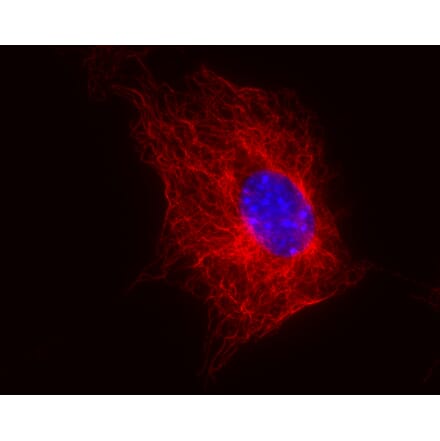 Immunocytochemistry - Anti-beta Tubulin Antibody [TU-06] (A86334) - Antibodies.com