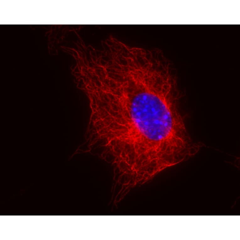 Immunocytochemistry - Anti-beta Tubulin Antibody [TU-06] (A86334) - Antibodies.com
