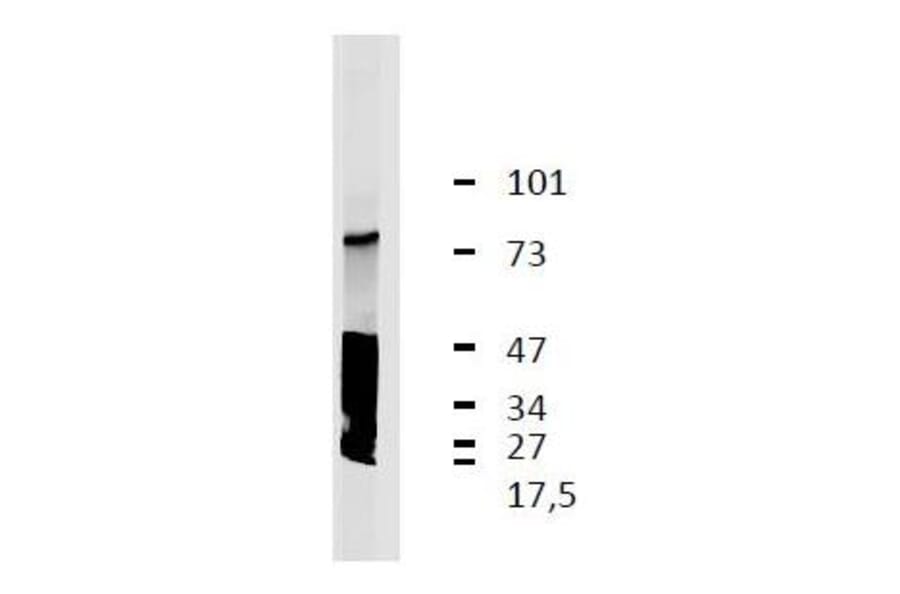 WB - Anti-LRRC32 Antibody [GARP5] (A86349)