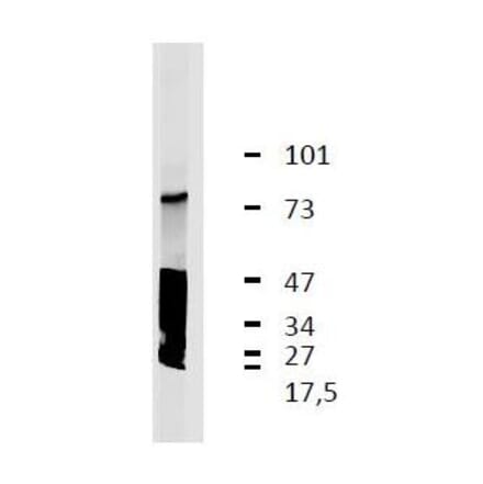WB - Anti-LRRC32 Antibody [GARP5] (A86349)