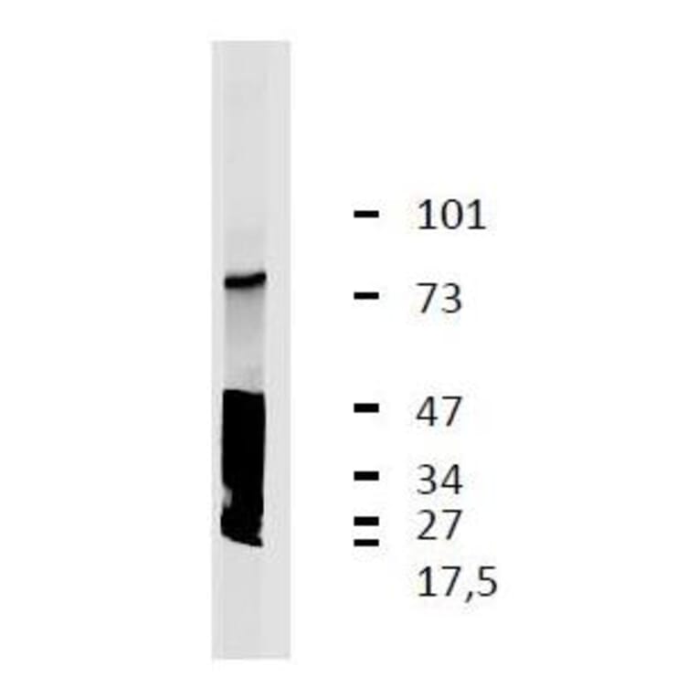 WB - Anti-LRRC32 Antibody [GARP5] (A86349)