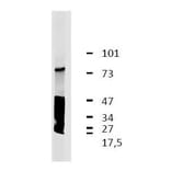 WB - Anti-LRRC32 Antibody [GARP5] (A86349)