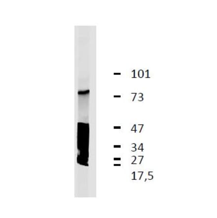 Western Blot - Anti-LRRC32 Antibody [GARP5] (A86344) - Antibodies.com