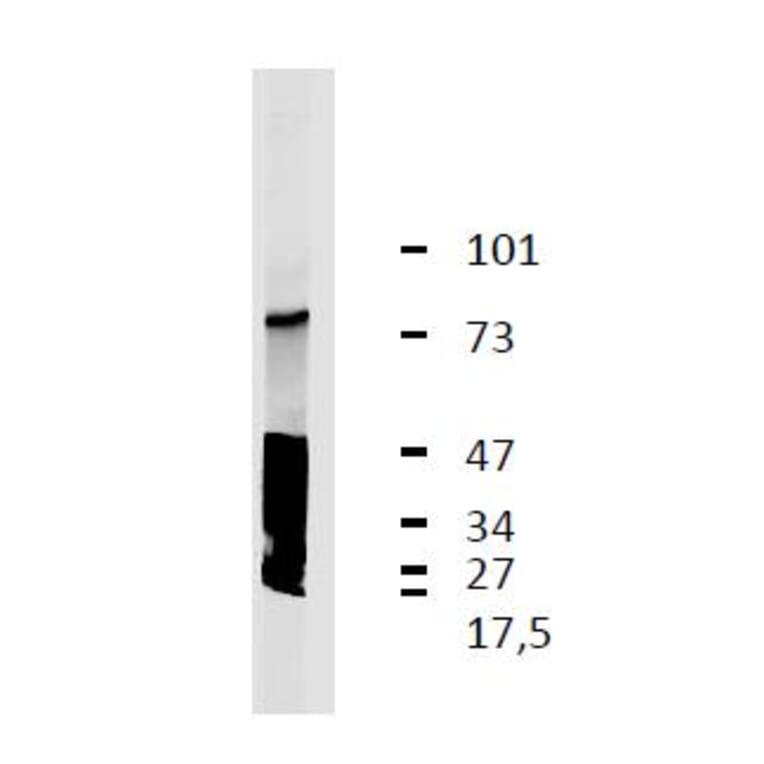 Western Blot - Anti-LRRC32 Antibody [GARP5] (A86344) - Antibodies.com