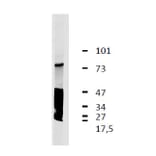 Western Blot - Anti-LRRC32 Antibody [GARP5] (A86344) - Antibodies.com