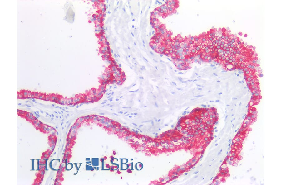 IHC - Anti-Cytokeratin 19 Antibody [A53-B/A2] (A86355)