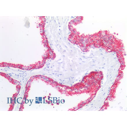 IHC - Anti-Cytokeratin 19 Antibody [A53-B/A2] (A86355)