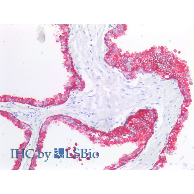 IHC - Anti-Cytokeratin 19 Antibody [A53-B/A2] (A86355)