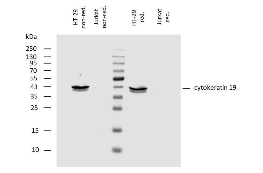 WB - Anti-Cytokeratin 19 Antibody [A53-B/A2] (A86355)