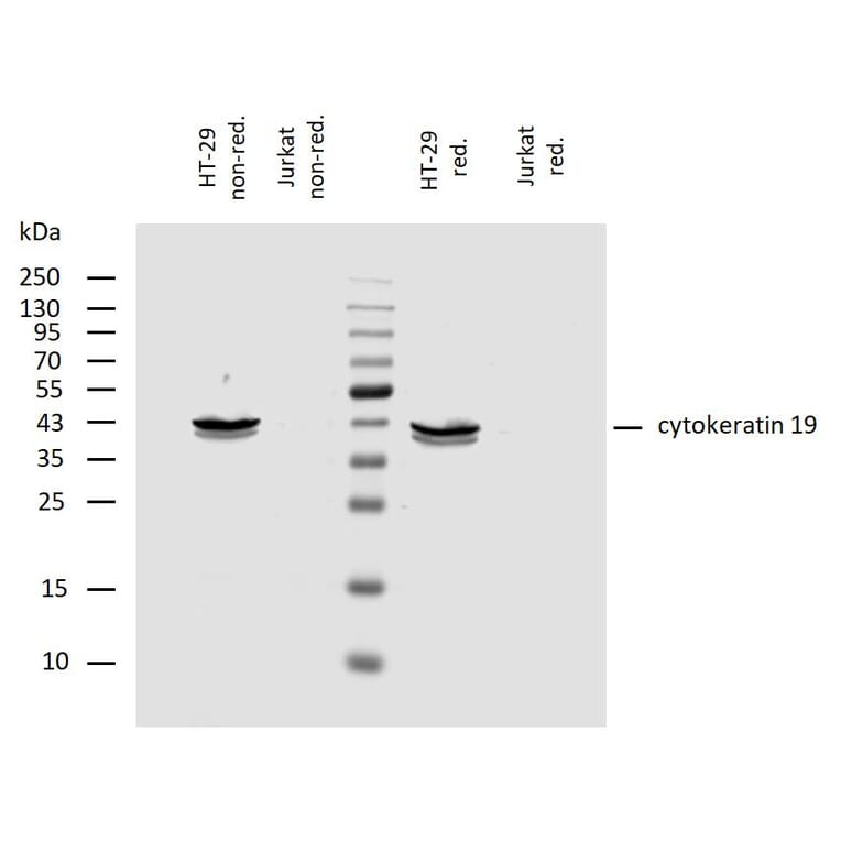 WB - Anti-Cytokeratin 19 Antibody [A53-B/A2] (A86355)