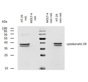 WB - Anti-Cytokeratin 19 Antibody [A53-B/A2] (Biotin) (A86358)