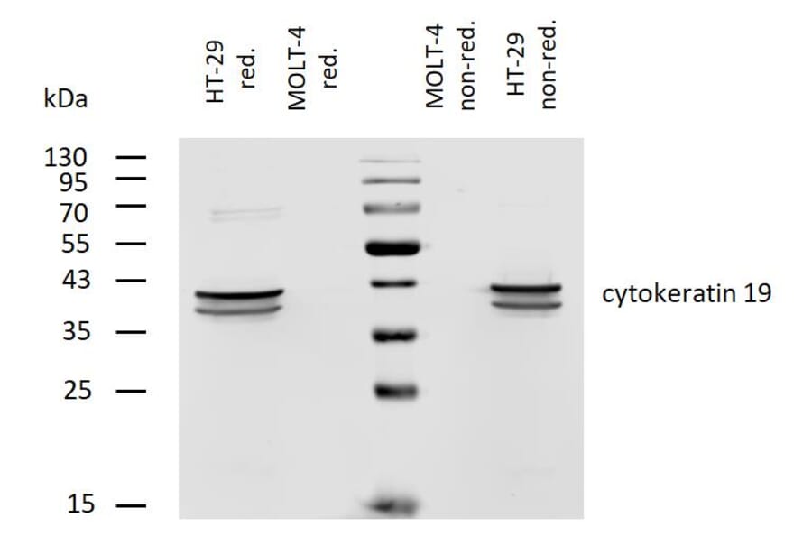 WB - Anti-Cytokeratin 19 Antibody [A53-B/A2] (Biotin) (A86358)