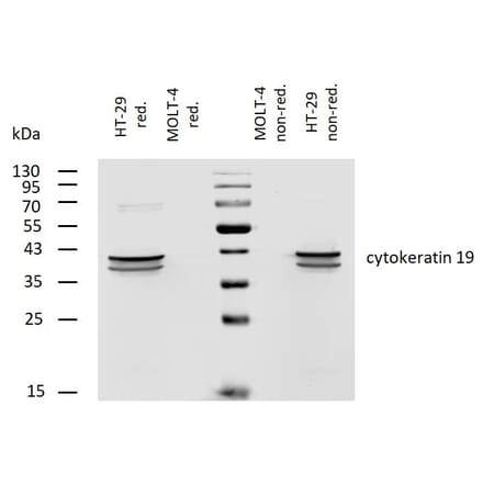 WB - Anti-Cytokeratin 19 Antibody [A53-B/A2] (Biotin) (A86358)