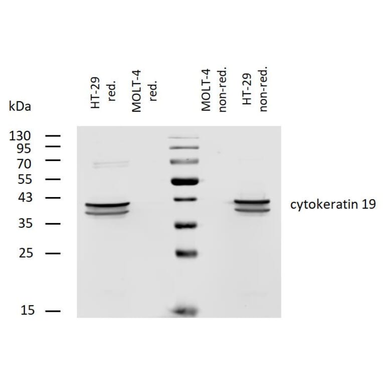 WB - Anti-Cytokeratin 19 Antibody [A53-B/A2] (Biotin) (A86358)